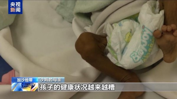 锅牛配资 没有食物和水 加沙孩子瘦成皮包骨 只能靠输液维持生命